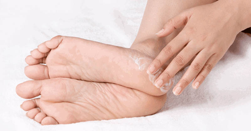 Da chân bị tróc vảy trắng là hiện tượng khá phổ biến