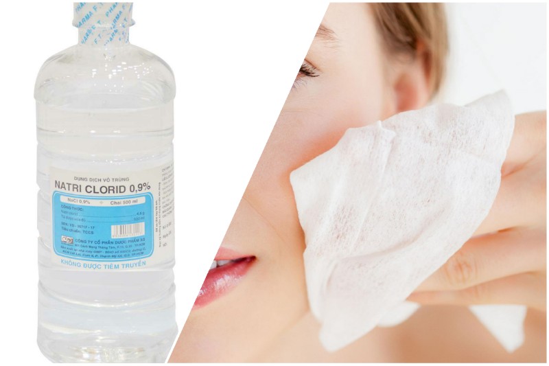 Bạn có thể dùng nước muối sinh lý để làm sạch da