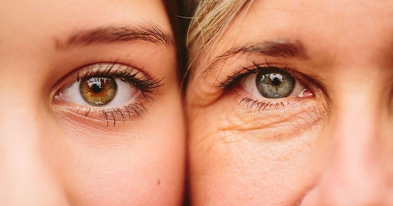 Hiện tượng lão hóa da vùng mắt rất dễ nhận biết