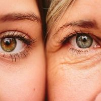 Cách chống lão hóa da vùng mắt tốt nhất