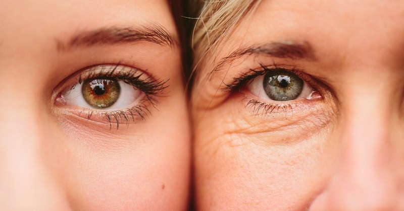 Tuổi tác là nguyên nhân chính khiến vùng da mắt trở nên nhăn nheo, xấu xí