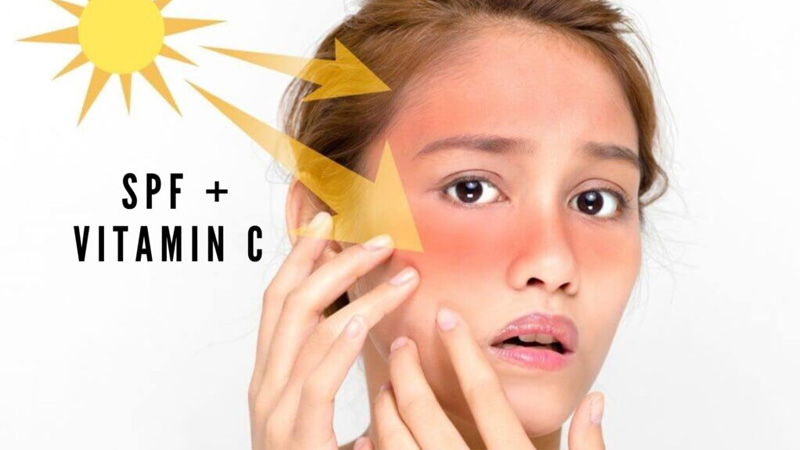 Bộ đôi vitamin C và kem chống nắng giúp bảo vệ da hiệu quả