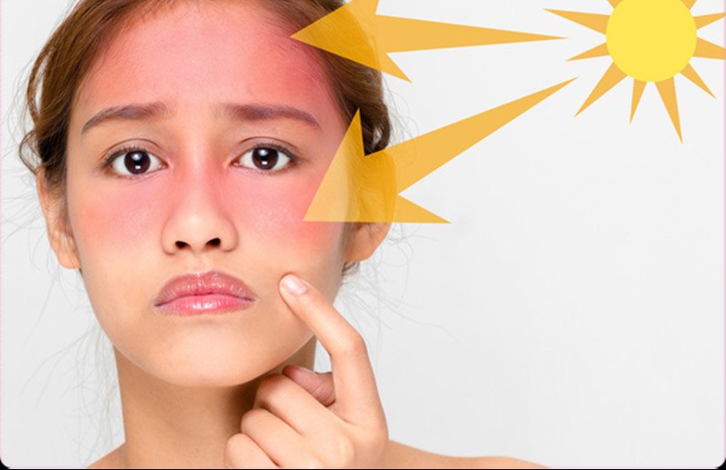 Trong tia nắng mặt trời có nhiều tác động gây lại lên da